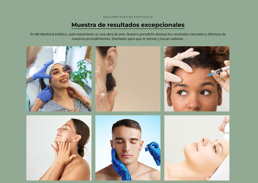 sitio web medicina estetica galeria de fotos